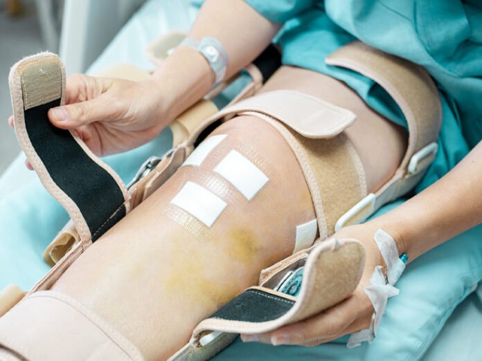 knee joint replacement