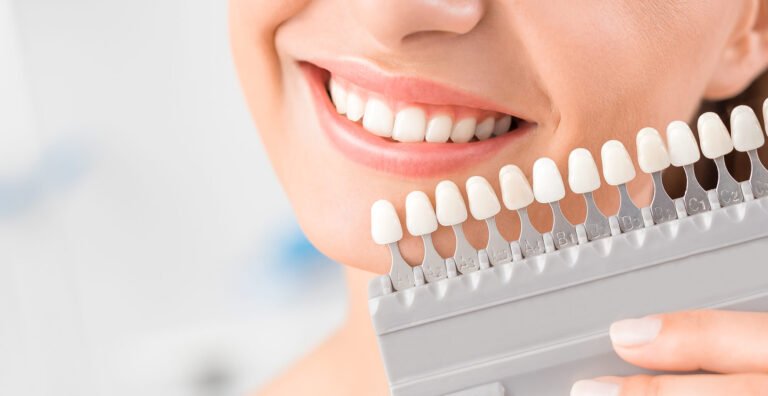 Improve One’s Smile: The Benefits of Dental Implants
