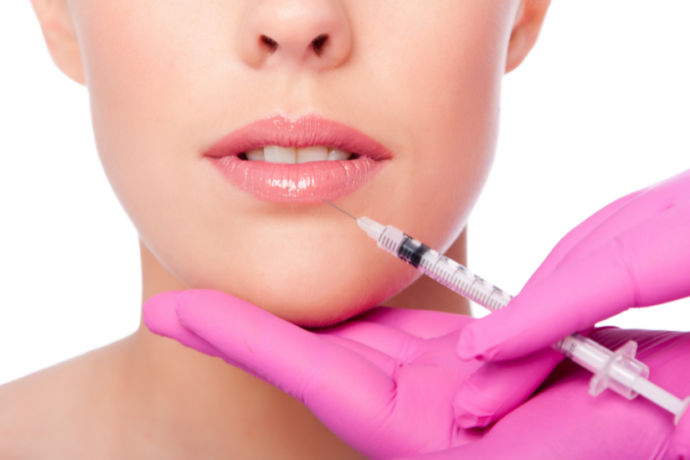 5 Reasons to Consider Getting a Lip Enhancement