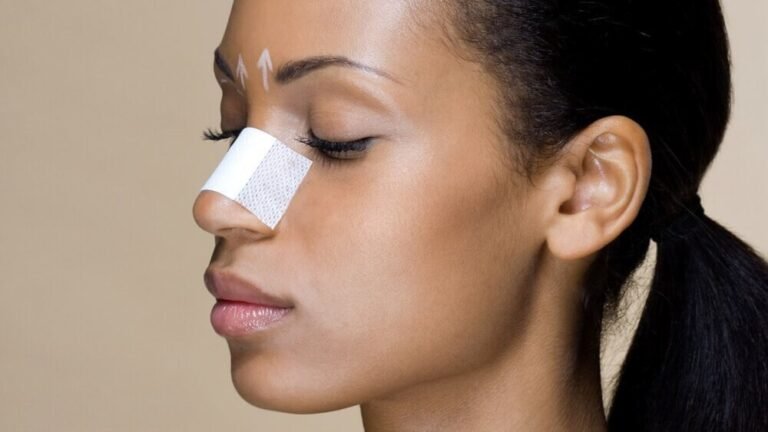 Common Injuries Resulting in Rhinoplasty