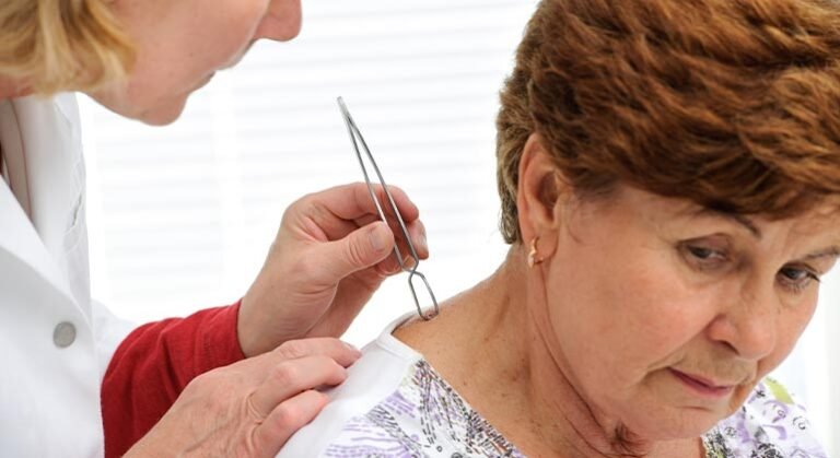 7 Common Diseases Transmitted by Insects and Ticks